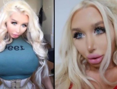 Αυτή είναι η 22χρονη που ξόδεψε 40.000 λίρες για να «γίνει» η Μπάρμπι - Και απέτυχε παταγωδώς (φώτο)